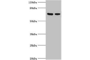 Western blot All lanes: TCTN2 antibody at 10 μg/mL Lane 1: Jurkat whole cell lysate Lane 2: A549 whole cell lysate Secondary Goat polyclonal to rabbit IgG at 1/10000 dilution Predicted band size: 77 kDa Observed band size: 77 kDa (TCTN2 antibody  (AA 420-670))