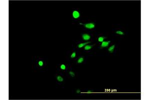 Immunofluorescence of monoclonal antibody to NR4A3 on HeLa cell. (NR4A3 antibody  (AA 414-521))