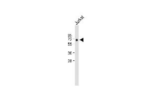 Anti-RUNX2 Antibody at 1:2000 dilution + Jurkat whole cell lysate Lysates/proteins at 20 μg per lane. (RUNX2 antibody  (AA 445-474))