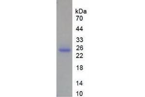 SDS-PAGE analysis of Human MMP13 Protein. (MMP13 Protein)