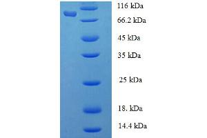Phenylalanyl-tRNA Synthetase, alpha Subunit (FARSA) (AA 2-508) protein (His-SUMO Tag)