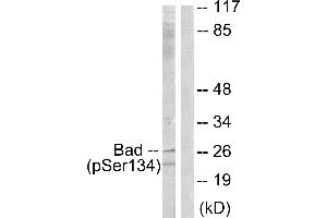 Immunohistochemistry analysis of paraffin-embedded human brain tissue using BAD (Phospho-Ser134) antibody. (BAD antibody  (pSer134))