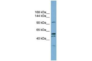 Anoctamin 6 antibody used at 1 ug/ml to detect target protein.