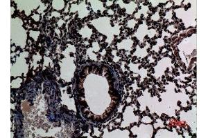 Immunohistochemistry (IHC) image for anti-Signal Transducer and Activator of Transcription 2, 113kDa (STAT2) (Tyr1221), (Tyr1222) antibody (ABIN6284459)