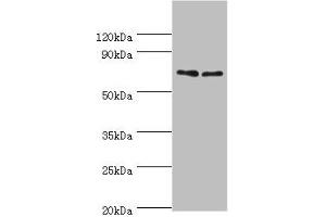 Western blot All lanes: TNFRSF21 antibody at 4 μg/mL Lane 1: K562 whole cell lysate Lane 2: Jurkat whole cell lysate Secondary Goat polyclonal to rabbit IgG at 1/10000 dilution Predicted band size: 72 kDa Observed band size: 72 kDa (TNFRSF21 antibody  (AA 371-655))