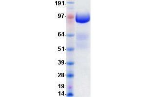 Western Blotting (WB) image for Fms-Related Tyrosine Kinase 4 (FLT4) protein (DYKDDDDK-His Tag) (ABIN2735244)