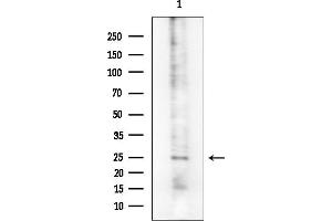 Western blot analysis of lysates from Rat brain, using Phospho-C (Tyr218) Antibody at 1/1000 dilution.