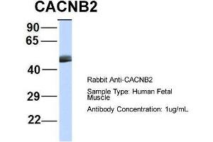 Host:  Rabbit  Target Name:  CACNB2  Sample Type:  Human Fetal Muscle  Antibody Dilution:  1. (CACNB4 antibody  (Middle Region))
