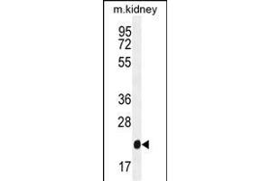 GPX3 Antibody (Center) (ABIN650617 and ABIN2844787) western blot analysis in mouse kidney tissue lysates (35 μg/lane). (GPX3 antibody  (AA 93-123))