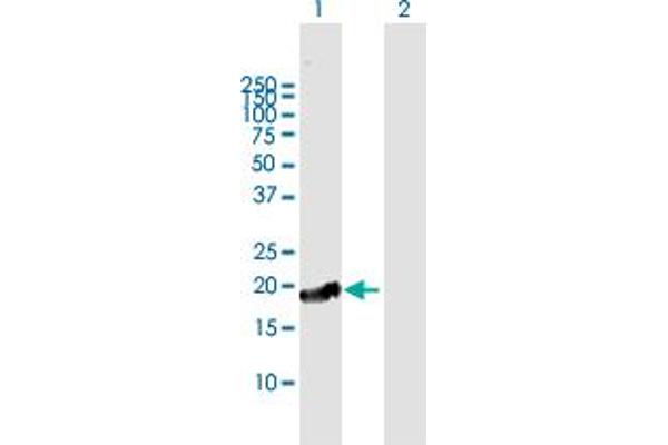 CTAG1A antibody  (AA 1-180)
