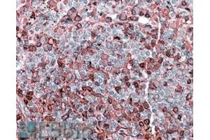 ABIN571020 (3. (NFAT1 antibody  (Internal Region))