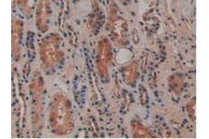IHC-P analysis of Human Kidney Tissue, with DAB staining. (Osteopontin antibody  (AA 17-287))
