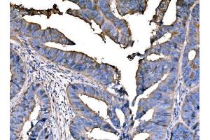 IHC analysis of PPFIA1 using anti-PPFIA1 antibody (ABIN7600454). (PPFIA1 antibody  (AA 198-1202))
