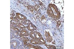 IHC analysis of MFF using anti-MFF antibody (ABIN7599292). (MFF antibody  (AA 1-342))
