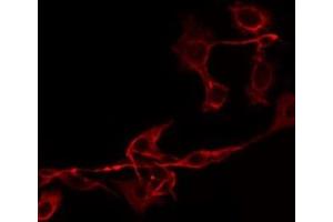 ABIN6275773 staining HepG2 by IF/ICC. (IL18BP antibody  (C-Term))