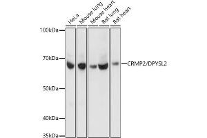 Western blot analysis of extracts of various cell lines, using CRMP2/DPYSL2 Rabbit mAb  at 1:1000 dilution. (DPYSL2 antibody)