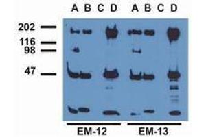 Western Blotting (WB) image for anti-Epidermal Growth Factor Receptor (EGFR) (pTyr1016) antibody (ABIN400878) (EGFR antibody  (pTyr1016))