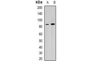 Western blot analysis of RPGR expression in Y79 (A), mouse heart (B) whole cell lysates. (RPGR antibody)