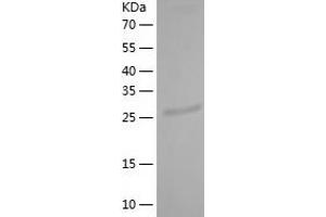 Western Blotting (WB) image for Zinc Finger Protein 28 (ZFP28) (AA 21-278) protein (His tag) (ABIN7287984) (ZFP28 Protein (AA 21-278) (His tag))