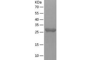 Western Blotting (WB) image for Hydroxyacylglutathione Hydrolase (HAGH) (AA 1-260) protein (His tag) (ABIN7123380) (HAGH Protein (AA 1-260) (His tag))