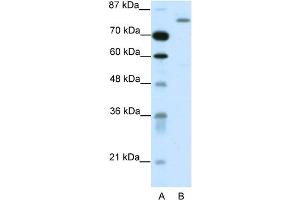 WB Suggested Anti-TRIM28 Antibody Titration:  1. (KAP1 antibody  (C-Term))