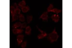 ABIN6276763 staining HeLa by IF/ICC. (MUTYH antibody  (Internal Region))