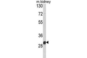 Western blot analysis of NAT2 Antibody (C-term) in mouse kidney tissue lysates (35ug/lane). (NAT2 antibody  (C-Term))