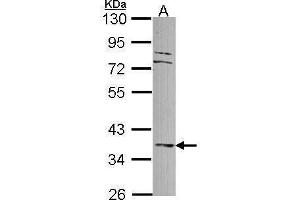 WB Image Sample (30 ug of whole cell lysate) A: A549 10% SDS PAGE antibody diluted at 1:1000 (DUSP6 antibody)