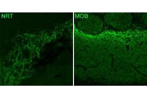 Indirect immunostaining of PFA fixed mouse brain sections (dilution 1 : 500). (GABRA3 antibody  (AA 29-43))