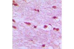 Immunohistochemical analysis of Lamin B1 staining in human brain formalin fixed paraffin embedded tissue section.