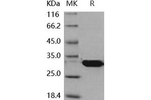 Latexin Protein (LXN) (His tag)