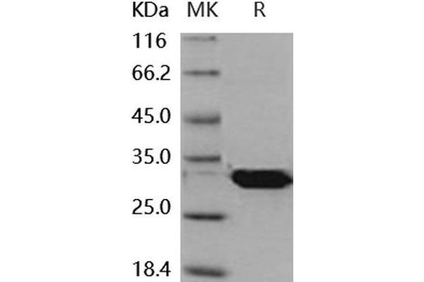 Latexin Protein (LXN) (His tag)