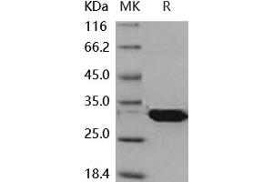 Western Blotting (WB) image for Latexin (LXN) (Active) protein (His tag) (ABIN7196737) (Latexin Protein (LXN) (His tag))