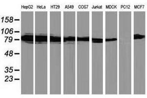 Image no. 2 for anti-Protein Kinase C, epsilon (PRKCE) antibody (ABIN1500229) (PKC epsilon antibody)