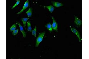 Immunofluorescent analysis of Hela cells using ABIN7152180 at dilution of 1:100 and Alexa Fluor 488-congugated AffiniPure Goat Anti-Rabbit IgG(H+L) (EIF4B antibody  (AA 362-590))