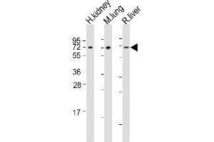 All lanes : Anti-ACSF2 Antibody (Center) at 1:2000 dilution Lane 1: human kidney lysates Lane 2: mouse lung lysates Lane 3: rat liver lysates Lysates/proteins at 20 μg per lane. (ACSF2 antibody  (AA 198-232))