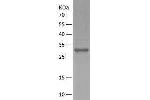 Western Blotting (WB) image for CD59 (CD59) (AA 26-102) protein (His-IF2DI Tag) (ABIN7283588) (CD59 Protein (CD59) (AA 26-102) (His-IF2DI Tag))