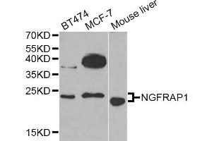 Western blot analysis of extracts of various cell lines, using NGFRAP1 Antibody (ABIN5974398) at 1/1000 dilution. (Nerve Growth Factor Receptor (TNFRSF16) Associated Protein 1 (NGFRAP1) antibody)