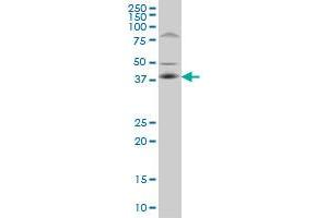 C10orf4 monoclonal antibody (M02), clone 2C4 Western Blot analysis of C10orf4 expression in PC-12 . (FRA10AC1 antibody  (AA 1-100))