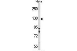 Western blot analysis of ITGA1 Antibody (Center) in Hela cell line lysates (35ug/lane). (Integrin alpha 1 antibody  (Middle Region))