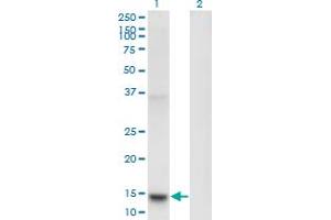 Western Blot analysis of PLA2G1B expression in transfected 293T cell line by PLA2G1B monoclonal antibody (M14), clone 2B7. (PLA2G1B antibody  (AA 17-70))