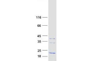 FXYD1 Protein (Transcript Variant A) (Myc-DYKDDDDK Tag)