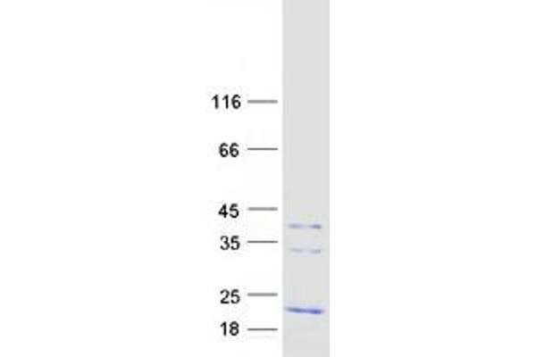 FXYD1 Protein (Transcript Variant A) (Myc-DYKDDDDK Tag)