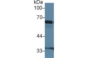 Western Blot; Sample: Mouse Lung lysate; Primary Ab: 2µg/ml Rabbit Anti-Mouse IkBz Antibody Second Ab: 0.