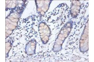 Immunohistochemistry of paraffin-embedded human small intestine tissue using ABIN7155104 at dilution of 1:100 (HNRNPD/AUF1 antibody  (AA 18-355))