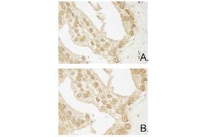 Immunohistochemistry of Mouse Anti-AKT3 antibody. (AKT3 antibody  (Internal Region))