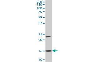 RPS17 monoclonal antibody (M01A), clone 2C7. (RPS17 antibody  (AA 36-135))