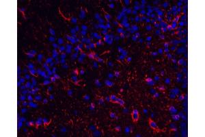Immunofluorescence analysis of paraffin-embedded rat brain using GFAP Monoclonal Antibody at dilution of 1:400. (GFAP antibody)