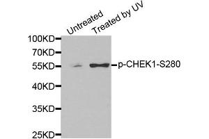 Western Blotting (WB) image for anti-Checkpoint Kinase 1 (CHEK1) (pSer280) antibody (ABIN1870069) (CHEK1 antibody  (pSer280))