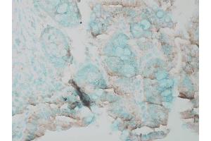 Immunohistochemistry (IHC) image for anti-Mitogen-Activated Protein Kinase 3 (MAPK3) antibody (ABIN361833)